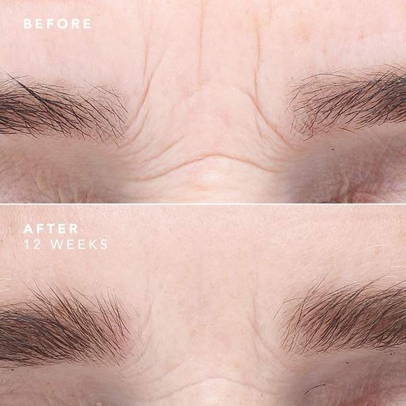 new BioEFFECT EGF Serum ❤︎ Anti Aging Plant Based ❤︎ Age Defying Skin Miracle - Picture 5 of 17